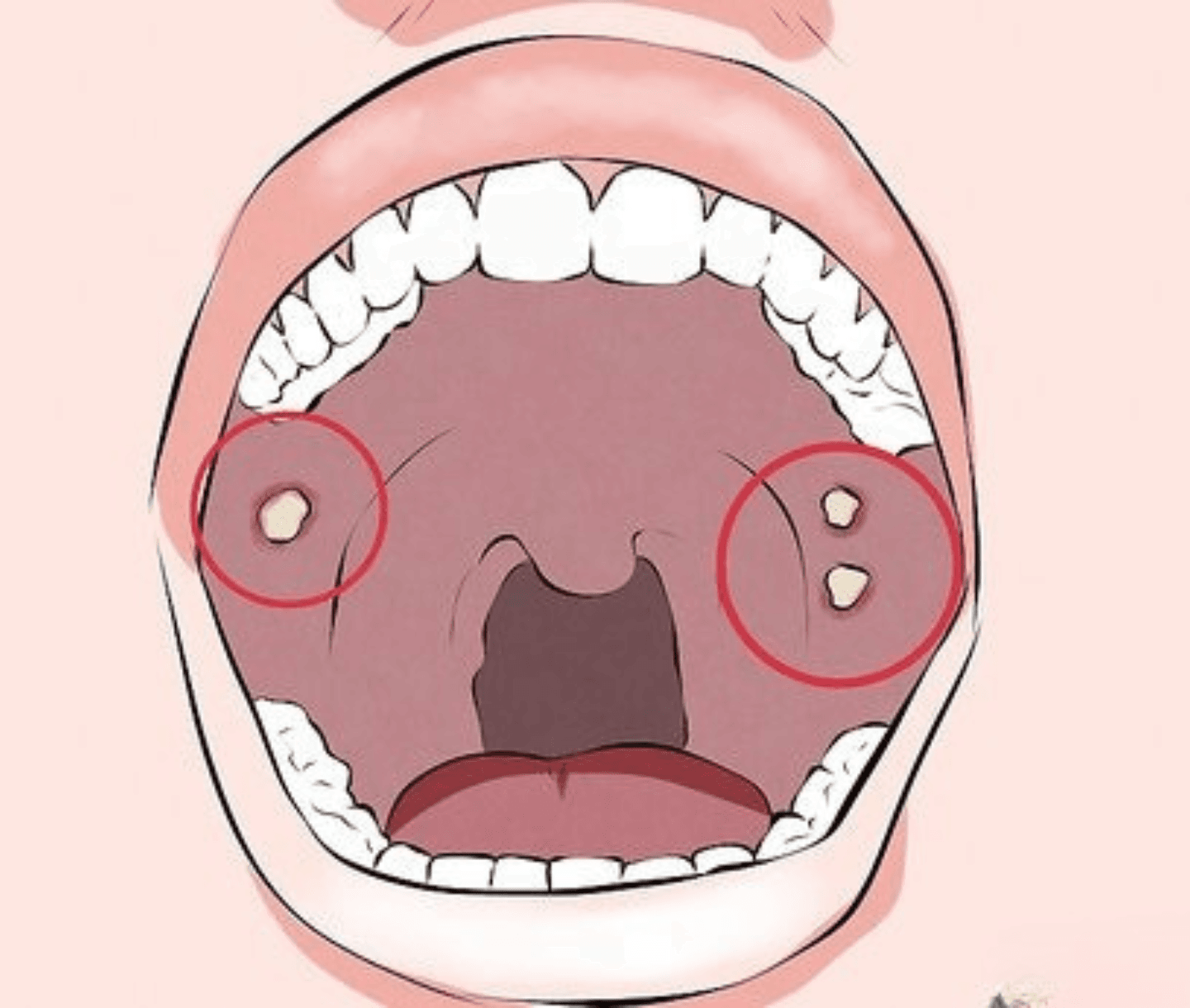 Oral & Head-and-Neck Cancer